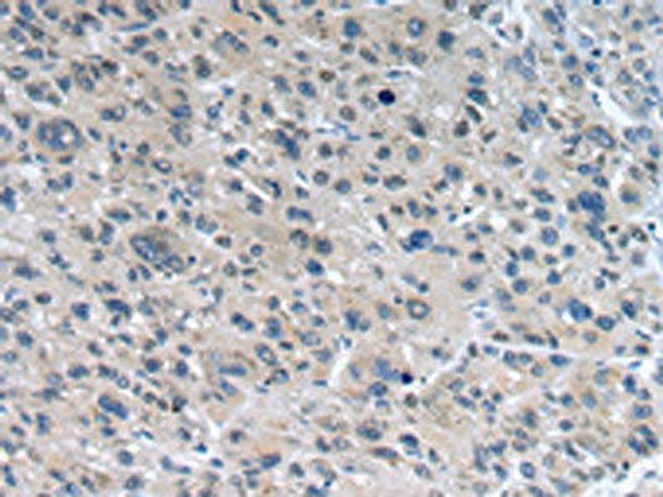 WNT10A Antibody (PACO20922)