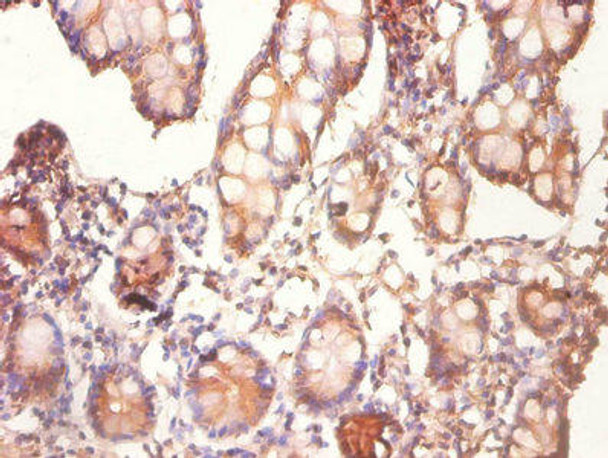 CDK2AP1 Antibody (PACO25672)