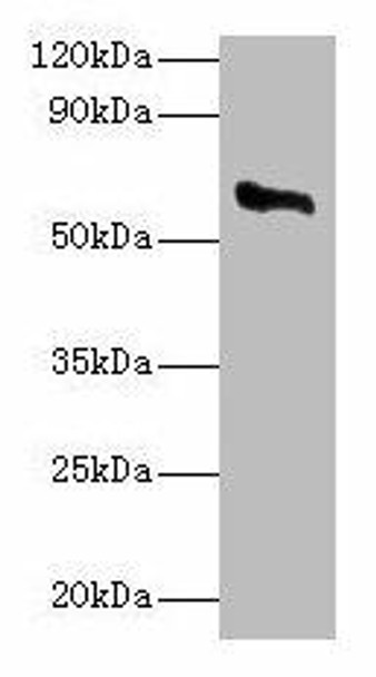 CYP11A1 Antibody (PACO26089)