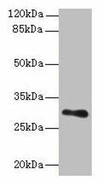 TMEM176B Antibody (PACO30514)