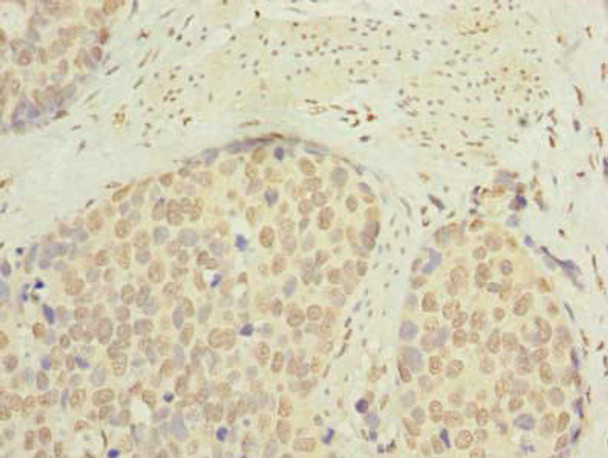 SLC22A18AS Antibody (PACO39382)