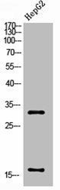 Cleaved-CASP3 (D175) Antibody (PACO06029)
