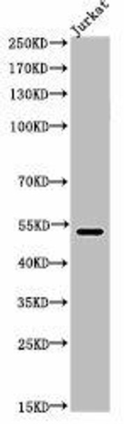 Acetyl-TP53 (K372) Antibody (PACO06066)