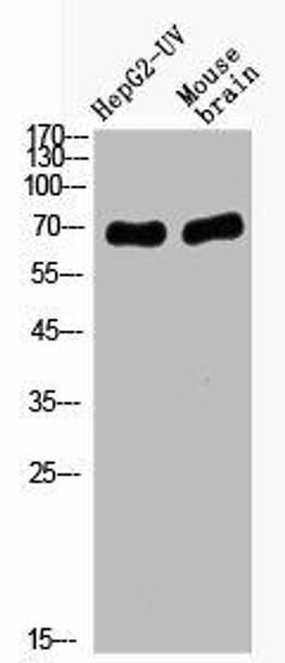 Acetyl-RELA (K221) Antibody (PACO06087)