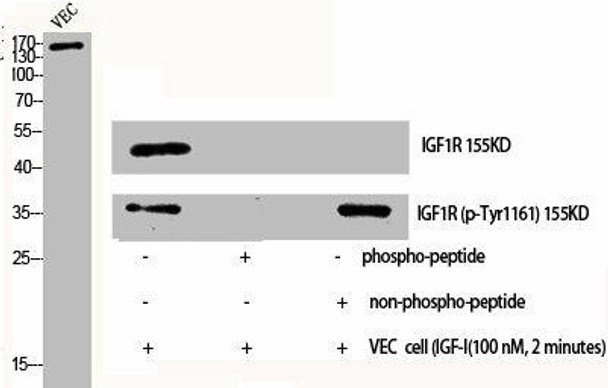 Phospho-IGF1R/INSR (Y1161) Antibody (PACO06130)