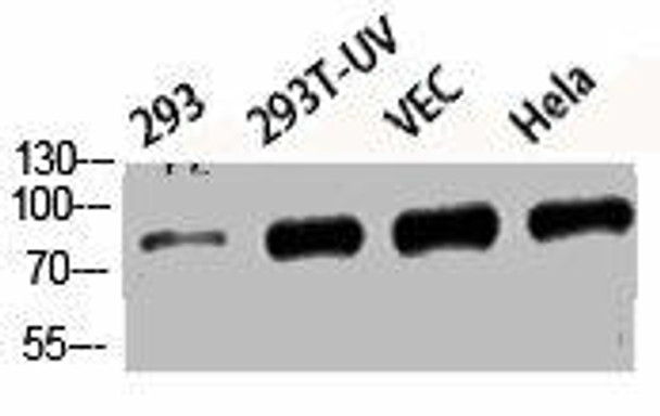 Phospho-MAPT (S396) Antibody (PACO06154)