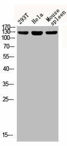 Phospho-IRS1 (S312) Antibody (PACO06172)