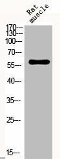 Phospho-SMAD2 (S467) Antibody (PACO06173)