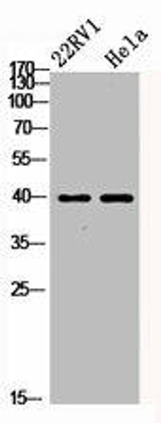 PRKACA/PRKACB/PRKACG Antibody (PACO06760)