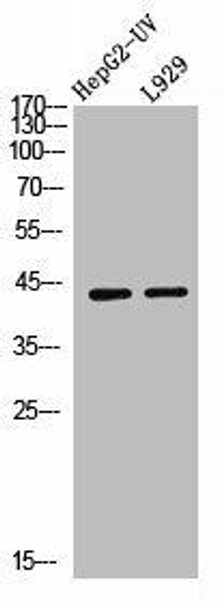 IL13RA2 Antibody (PACO06902)