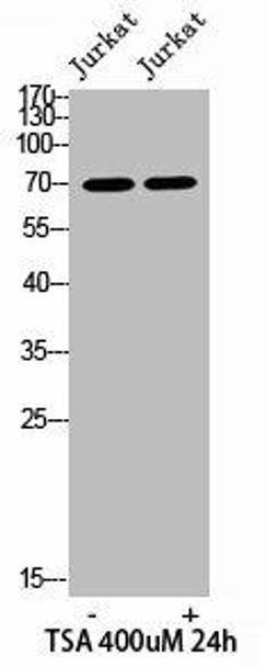 Acetyl-XRCC6 (K542) Antibody (PACO07060)