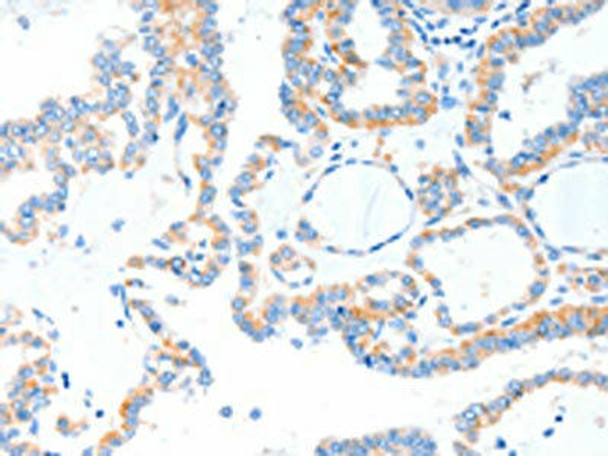 TLR2 Antibody (PACO13895)