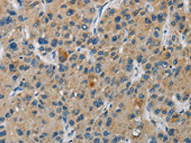 SAR1B Antibody (PACO14086)