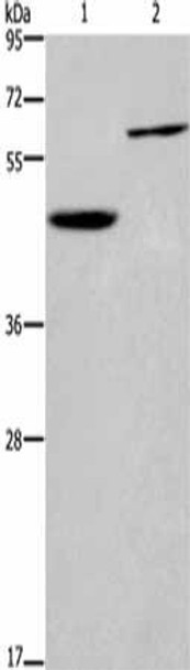 DOK1 Antibody (PACO14351)