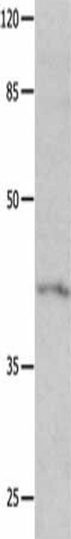 KCNA5 Antibody (PACO14615)