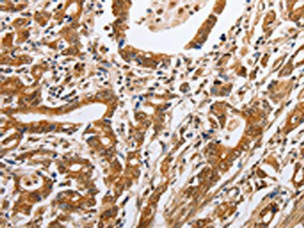 PSMD8 Antibody (PACO14930)