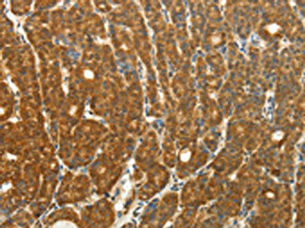 PTCH1 Antibody (PACO14940)