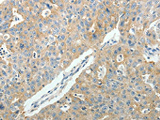 PTGDS Antibody (PACO14942)