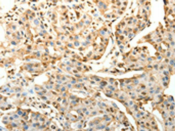 SPAG8 Antibody (PACO15028)