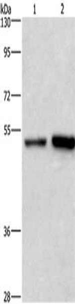 SYT4 Antibody (PACO15045)