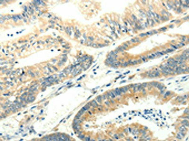 SYT5 Antibody (PACO15046)