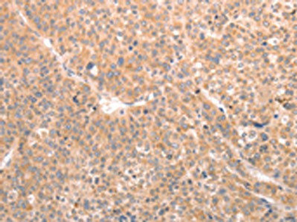 ABCF1 Antibody (PACO15229)