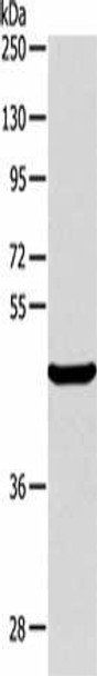 ALKBH1 Antibody (PACO15231)