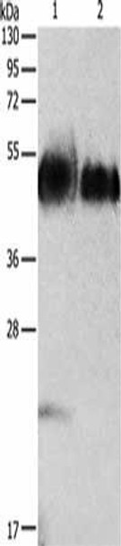 ORM1 Antibody (PACO15394)