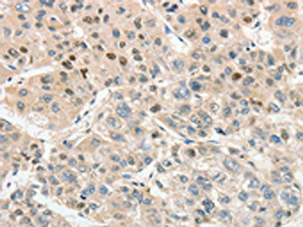 ANAPC5 Antibody (PACO15463)