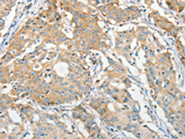 APOBEC3G Antibody (PACO15482)