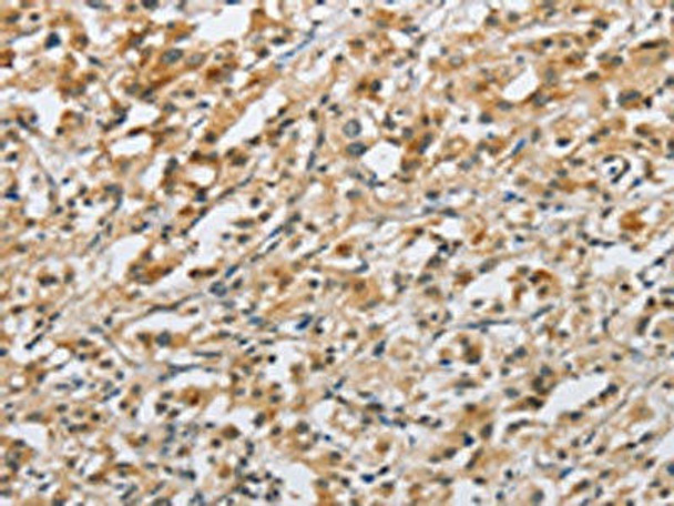 NAPSA Antibody (PACO15490)