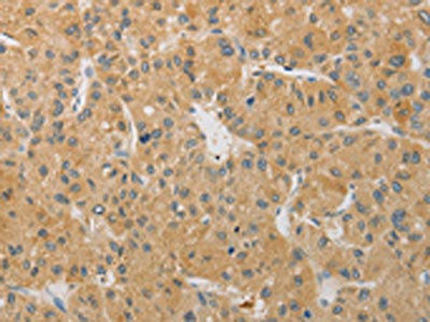 ARSK Antibody (PACO15561)