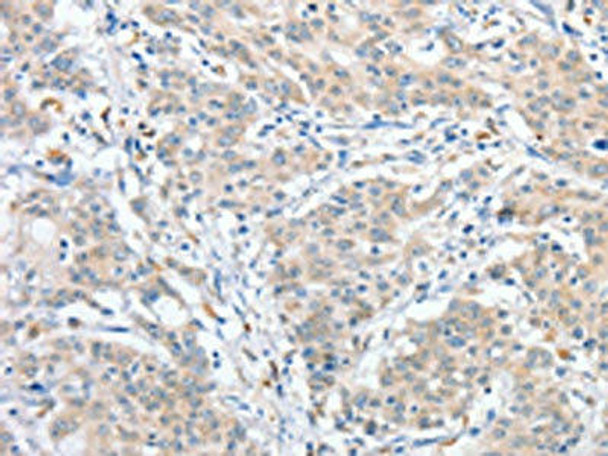 RPN1 Antibody (PACO15612)