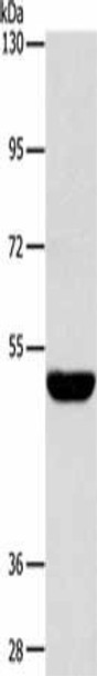 SPTLC1 Antibody (PACO15616)