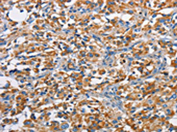 PIM2 Antibody (PACO15683)