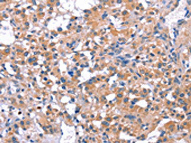 ELP2 Antibody (PACO15736)