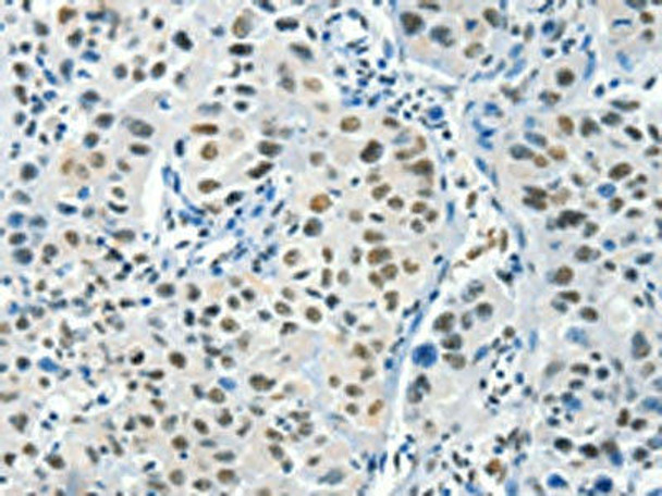 BCAS2 Antibody (PACO15852)