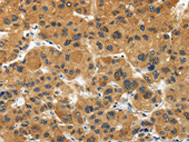 CALU Antibody (PACO15912)