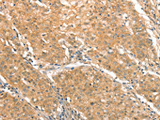 CXCR4 Antibody (PACO15961)