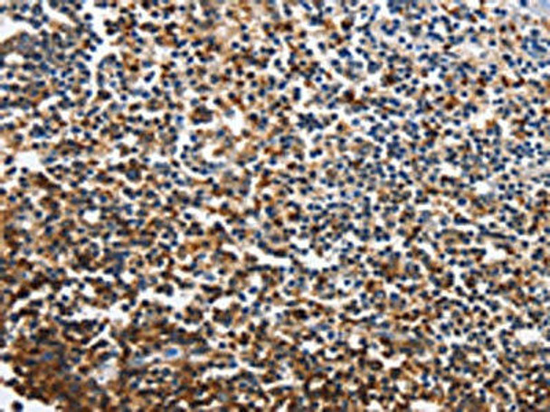 CDO1 Antibody (PACO16000)