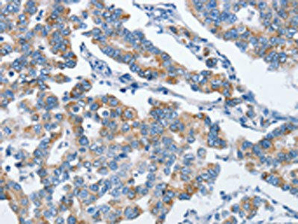 CHDH Antibody (PACO16024)