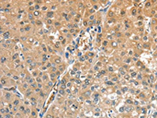 CIAPIN1 Antibody (PACO16032)
