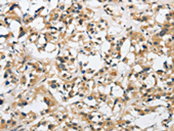 CKMT2 Antibody (PACO16040)