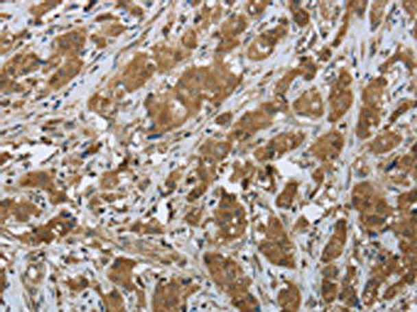 CLPS Antibody (PACO16044)