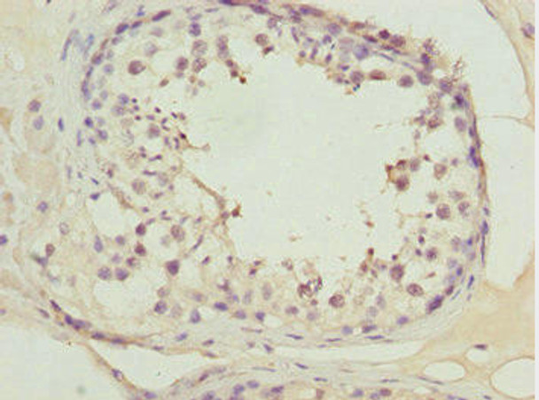 ATOH7 Antibody (PACO44607)