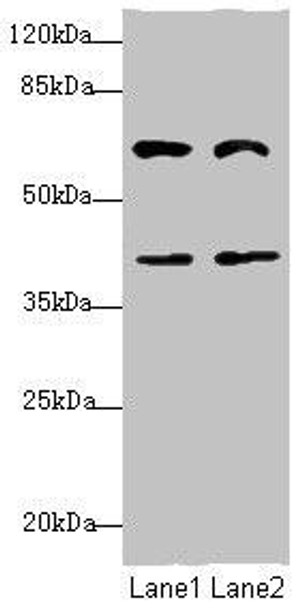 DCP1A Antibody (PACO44620)