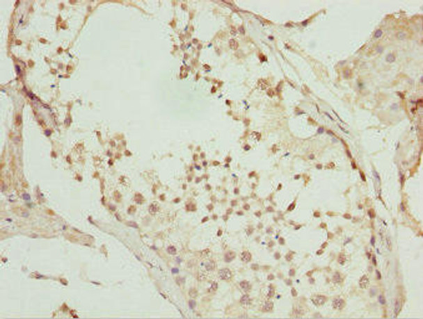 UBA6 Antibody (PACO44709)