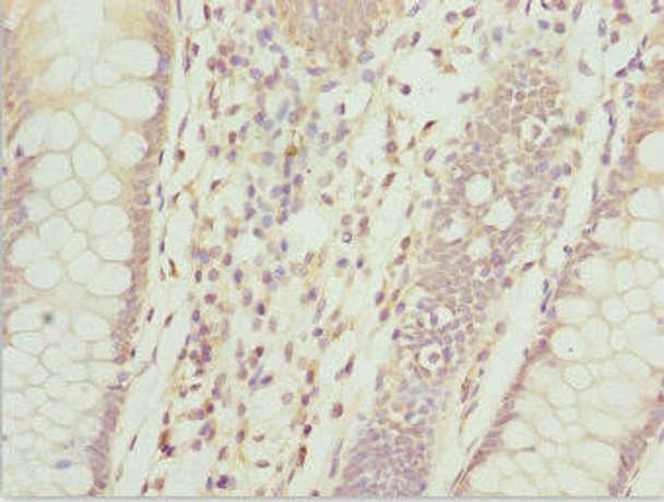 ZFAND3 Antibody (PACO44728)