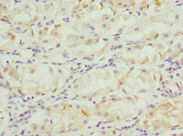 FGD5 Antibody (PACO44763)