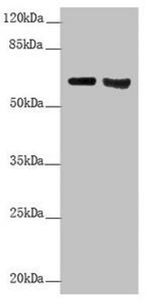 KRT6A Antibody (PACO44945)